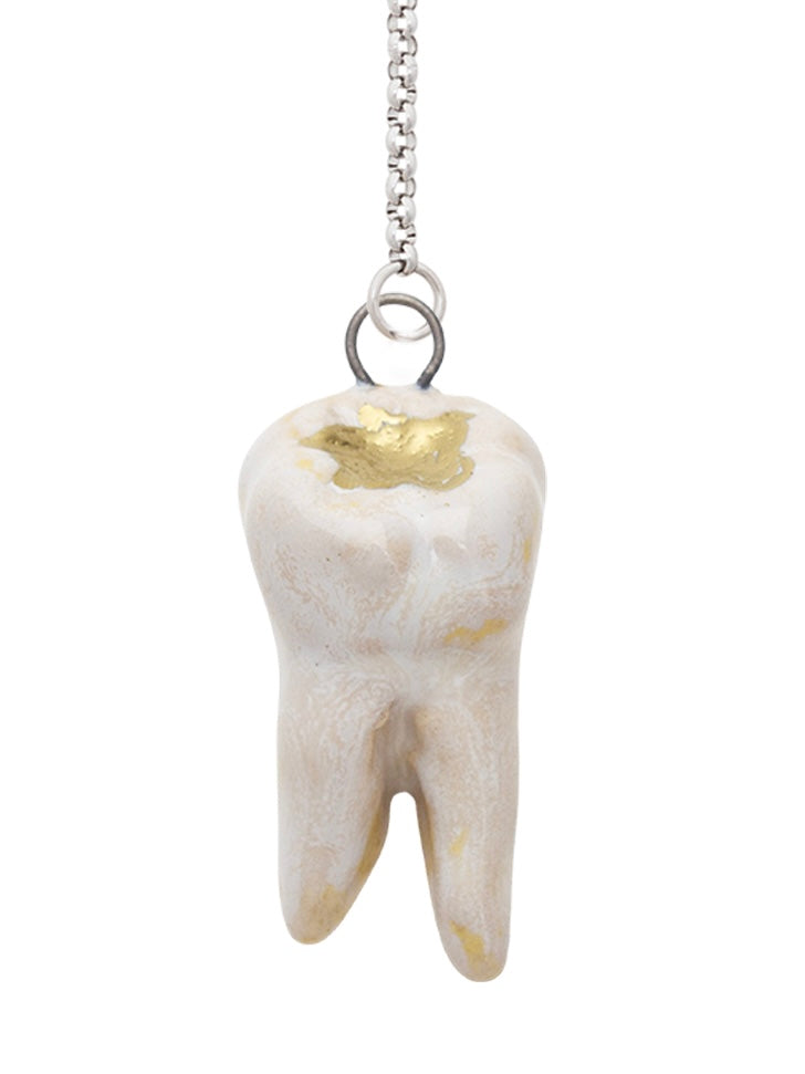 Gold Crown Teeth