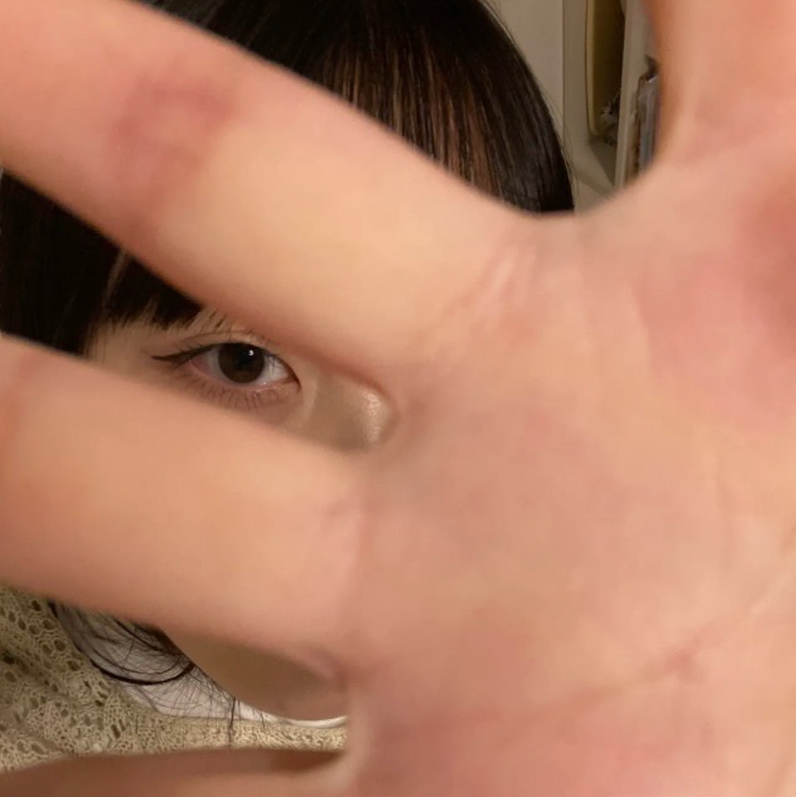 rui