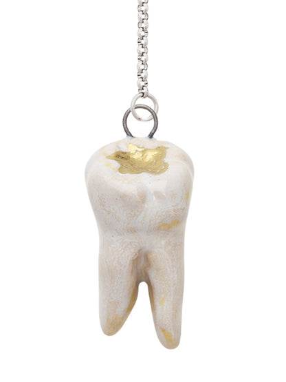 Gold Crown Teeth