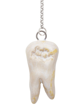 Gold Crown Teeth